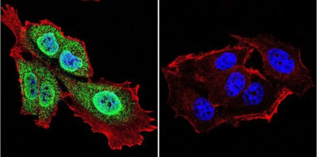 Presenilin 1 Antibody in Immunocytochemistry (ICC/IF)