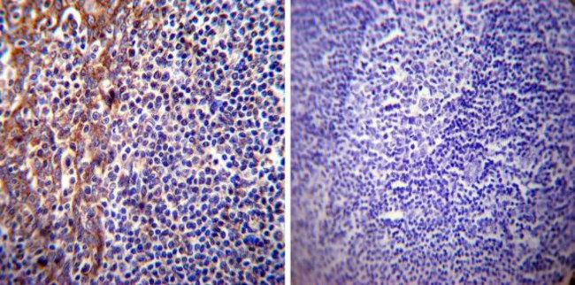 Presenilin 1 Antibody in Immunohistochemistry (Paraffin) (IHC (P))