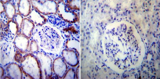 PSEN2 Antibody in Immunohistochemistry (Paraffin) (IHC (P))