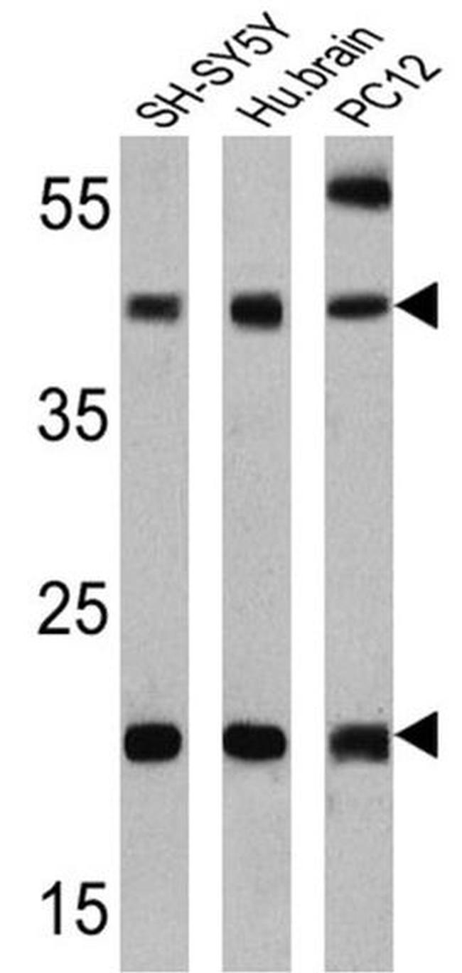 PSEN2 Antibody in Western Blot (WB)