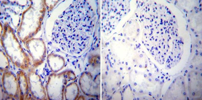 PSEN2 Antibody in Immunohistochemistry (Paraffin) (IHC (P))