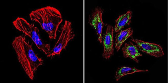 TIMP1 Antibody in Immunocytochemistry (ICC/IF)