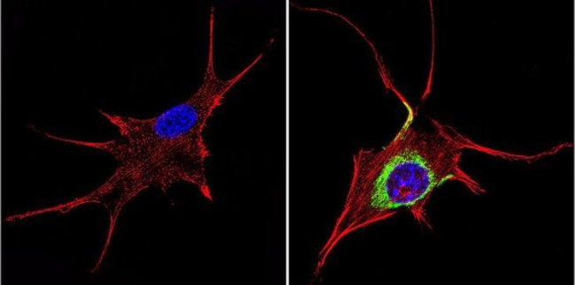 TIMP1 Antibody in Immunocytochemistry (ICC/IF)