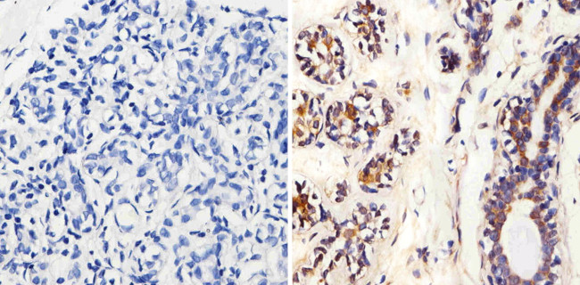 MMP2 Antibody in Immunohistochemistry (Paraffin) (IHC (P))