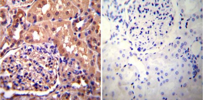 alpha Actinin 4 Antibody in Immunohistochemistry (Paraffin) (IHC (P))