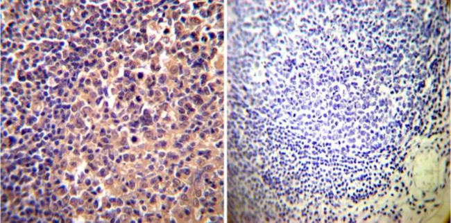 alpha Actinin 4 Antibody in Immunohistochemistry (Paraffin) (IHC (P))