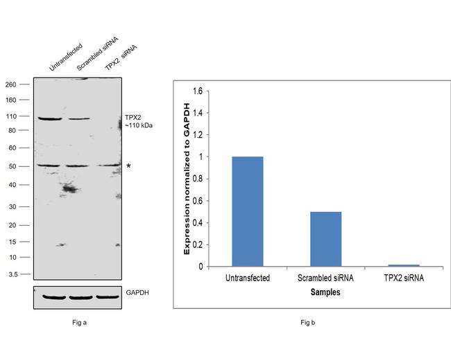 TPX2 Antibody in Western Blot (WB)