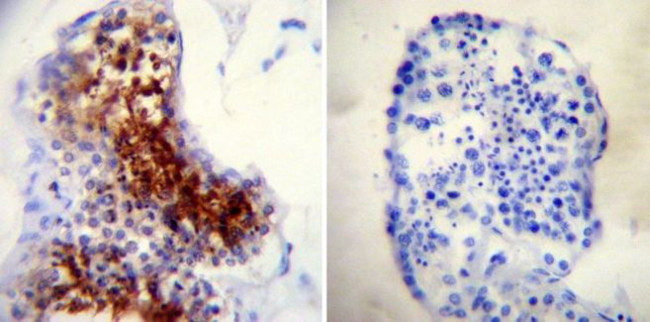 TPX2 Antibody in Immunohistochemistry (Paraffin) (IHC (P))