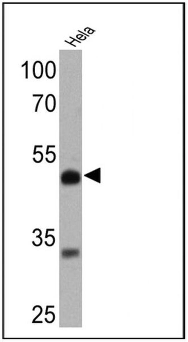 RARB Antibody in Western Blot (WB)