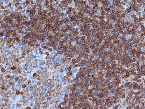 CD79a Antibody in Immunohistochemistry (Paraffin) (IHC (P))