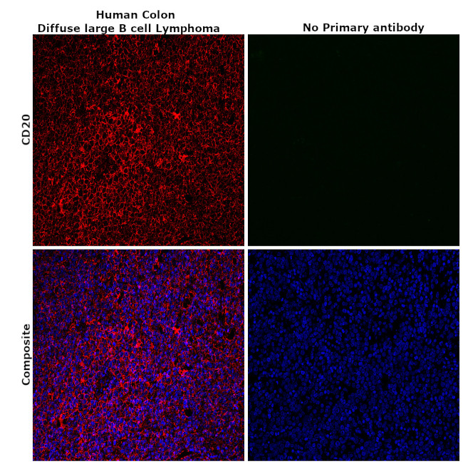 CD20 Antibody in Immunohistochemistry (Paraffin) (IHC (P))