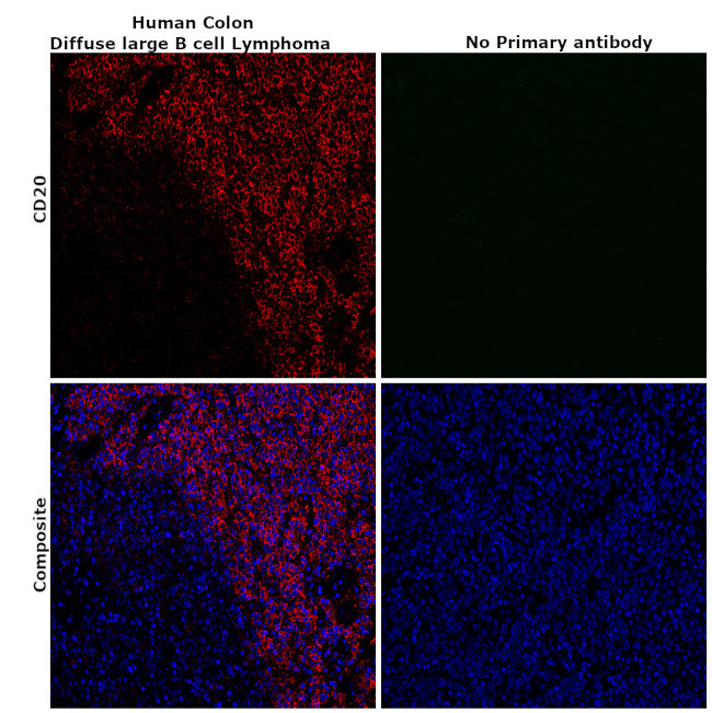 CD20 Antibody in Immunohistochemistry (Paraffin) (IHC (P))