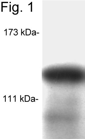 SRC1 Antibody in Western Blot (WB)