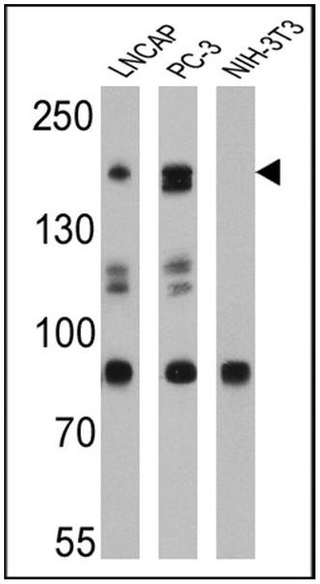 SRC1 Antibody in Western Blot (WB)