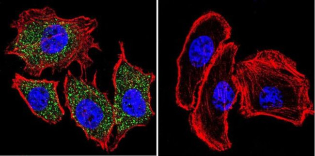 PLK1 Antibody in Immunocytochemistry (ICC/IF)