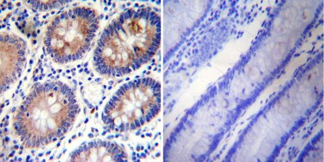 PLK1 Antibody in Immunohistochemistry (Paraffin) (IHC (P))