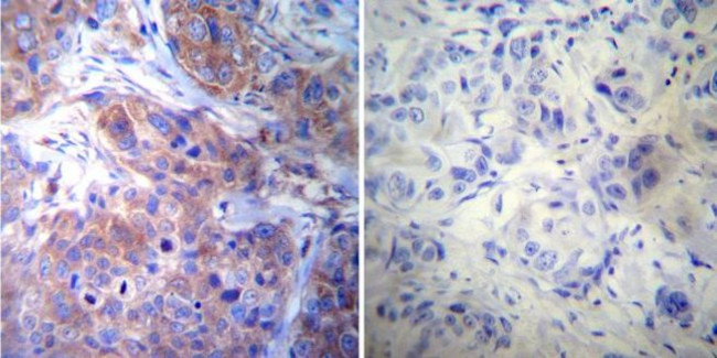 gamma Tubulin Antibody in Immunohistochemistry (Paraffin) (IHC (P))