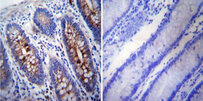 gamma Tubulin Antibody in Immunohistochemistry (Paraffin) (IHC (P))