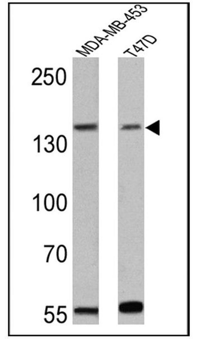 ErbB4 Antibody in Western Blot (WB)