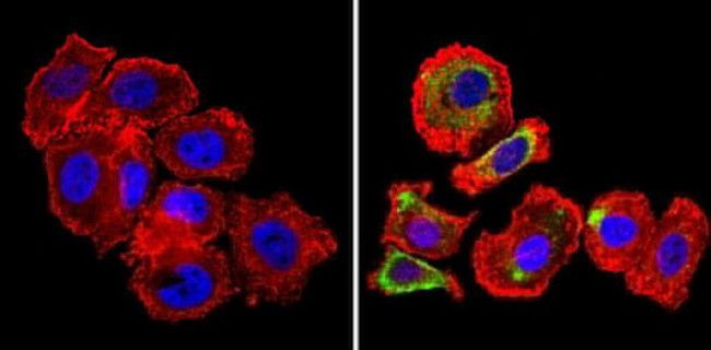 ErbB4 Antibody in Immunocytochemistry (ICC/IF)