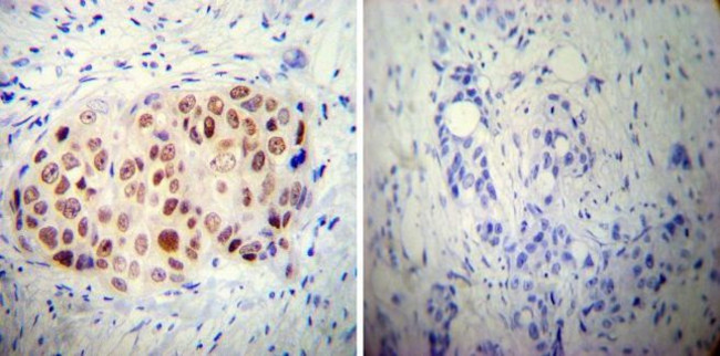 AP2 alpha Antibody in Immunohistochemistry (Paraffin) (IHC (P))