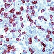 CD3e Antibody in Immunohistochemistry (Paraffin) (IHC (P))