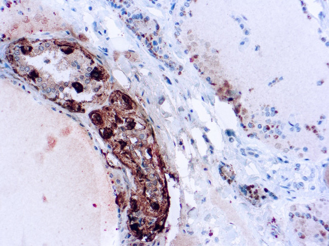 Calcitonin Antibody in Immunohistochemistry (Paraffin) (IHC (P))