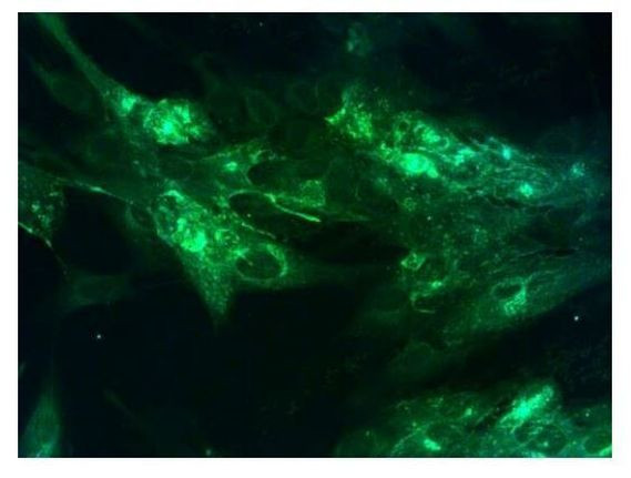 Varicella zoster Virus Antibody in Immunocytochemistry (ICC/IF)