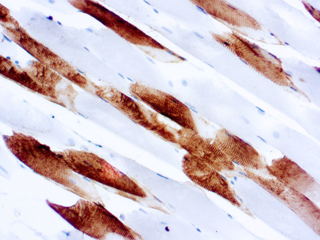 Myosin Skeletal Muscle Antibody in Immunohistochemistry (Paraffin) (IHC (P))