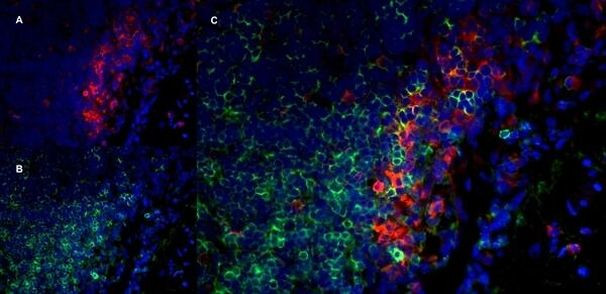 CD11b/c Antibody in Immunohistochemistry (Frozen) (IHC (F))