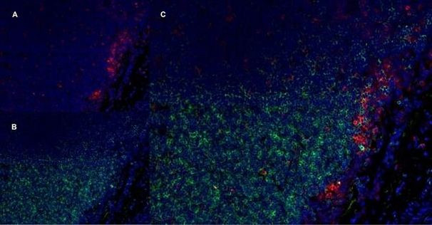 CD11b/c Antibody in Immunohistochemistry (Frozen) (IHC (F))