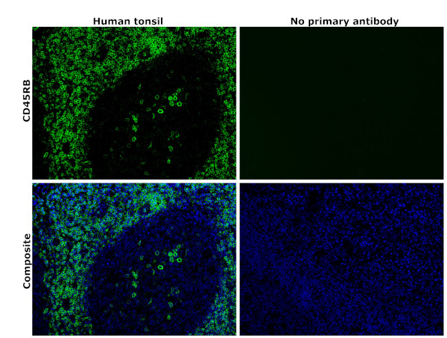 CD45RB Antibody in Immunohistochemistry (Paraffin) (IHC (P))