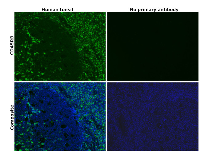 CD45RB Antibody in Immunohistochemistry (Paraffin) (IHC (P))