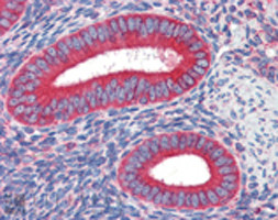 Calreticulin Antibody in Immunohistochemistry (IHC)