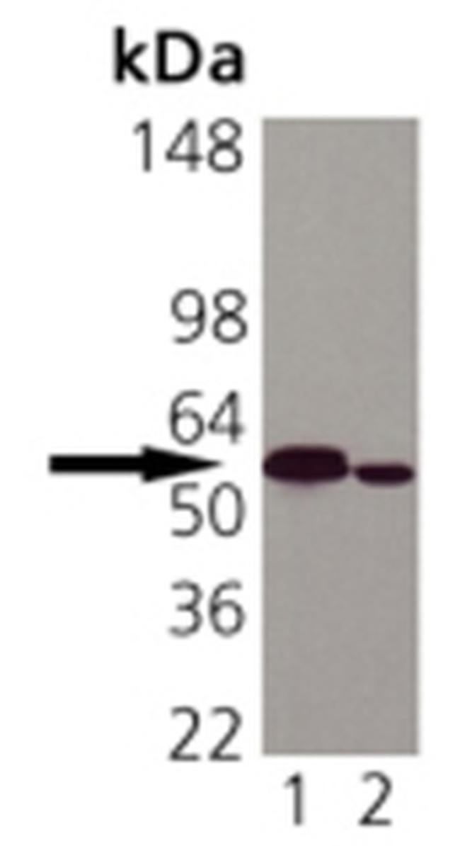 Calreticulin Antibody in Western Blot (WB)