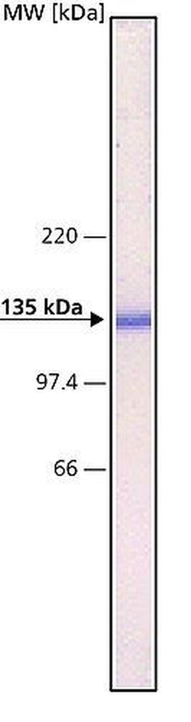 N-cadherin Antibody in Western Blot (WB)