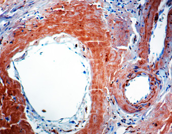 beta Amyloid Antibody in Immunohistochemistry (Paraffin) (IHC (P))