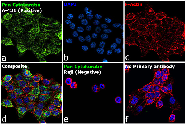 Cytokeratin Pan Antibody