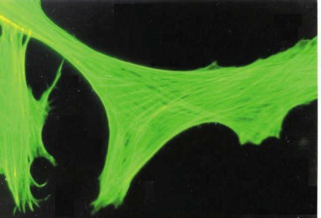 beta Actin Antibody in Immunocytochemistry (ICC/IF)