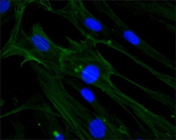 beta Actin Antibody in Immunocytochemistry (ICC/IF)