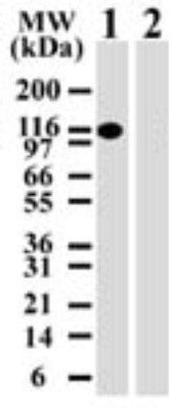 DNMT3A Antibody in Western Blot (WB)