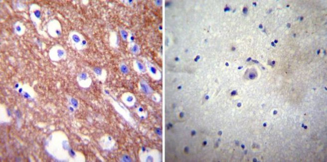 PMCA4 ATPase Antibody in Immunohistochemistry (Paraffin) (IHC (P))