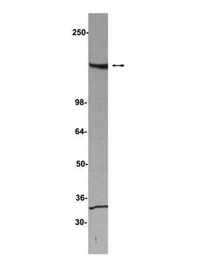 SAFB Antibody in Western Blot (WB)