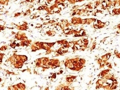 S100A7 Antibody in Immunohistochemistry (Paraffin) (IHC (P))