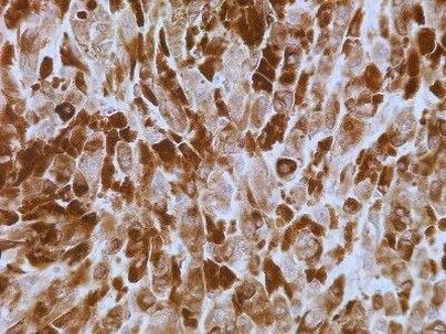 S100A7 Antibody in Immunohistochemistry (Paraffin) (IHC (P))