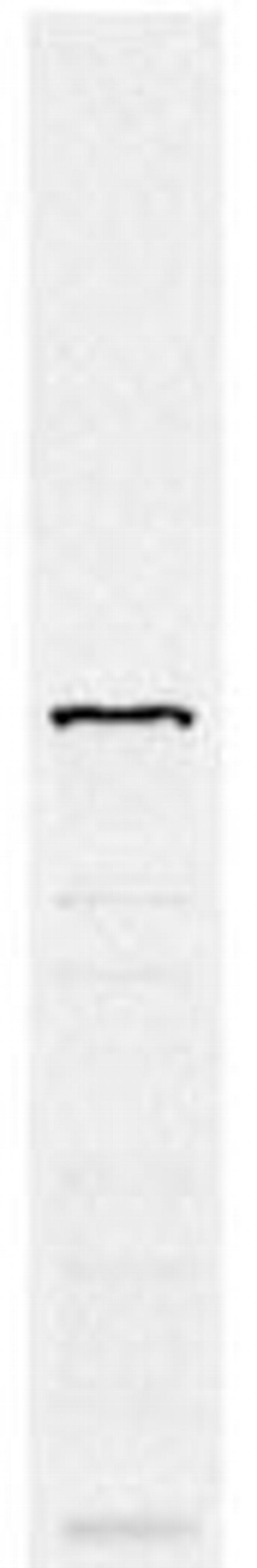 NOP58 Antibody in Western Blot (WB)