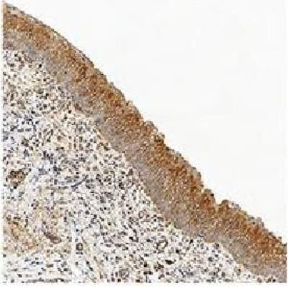 Active/Pro-Caspase 3 Antibody in Immunohistochemistry (Paraffin) (IHC (P))