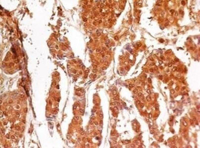 Active/Pro-Caspase 3 Antibody in Immunohistochemistry (Paraffin) (IHC (P))