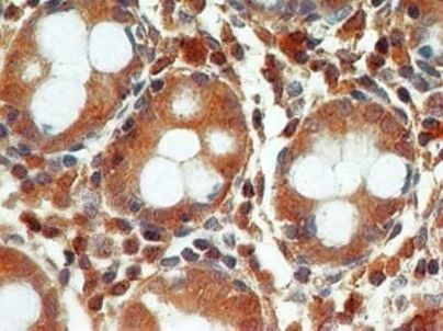 Active/Pro-Caspase 3 Antibody in Immunohistochemistry (Paraffin) (IHC (P))