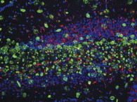 Nestin Antibody in Immunohistochemistry (IHC)